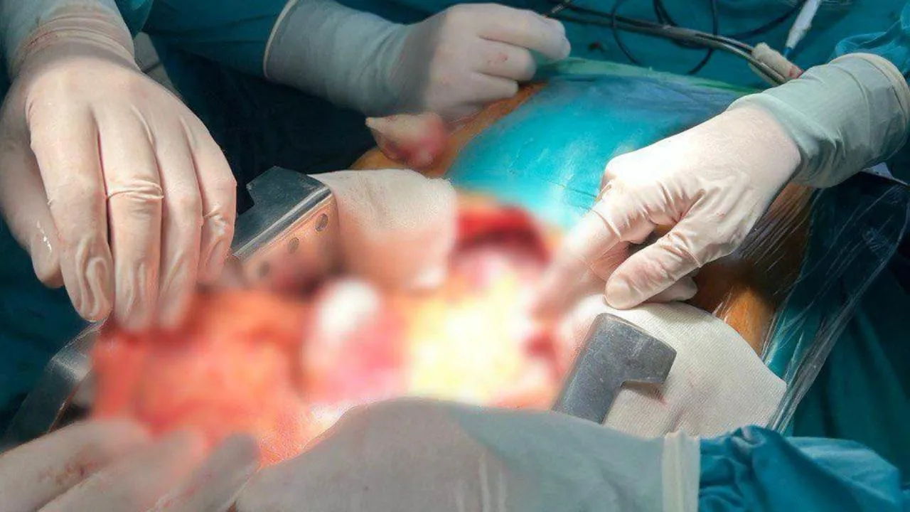 Двух пожилых женщин с разрывами аневризмы аорты спасли врачи в Мытищах