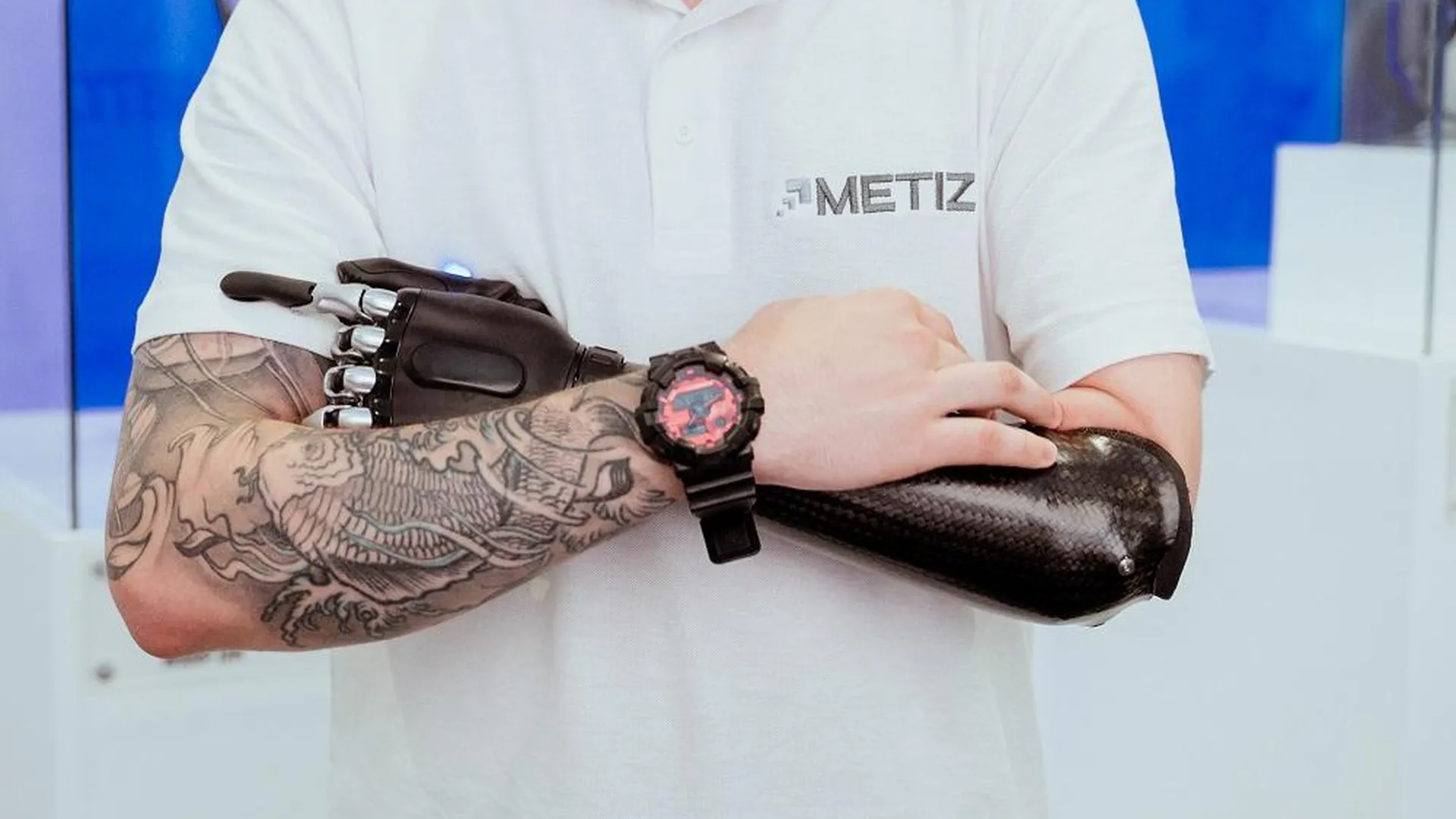 Компания «Метиз» в Щелкове приобрела стартап по созданию бионических протезов