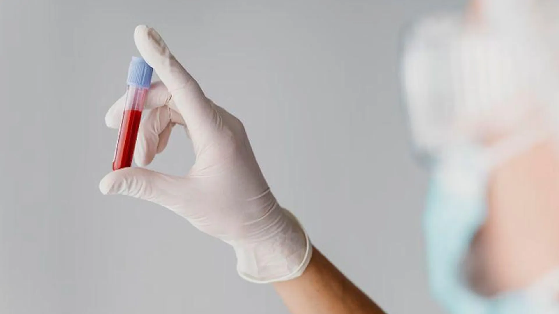 Российский эпидемиолог рассказал, что необходимо для создания вакцины от ВИЧ