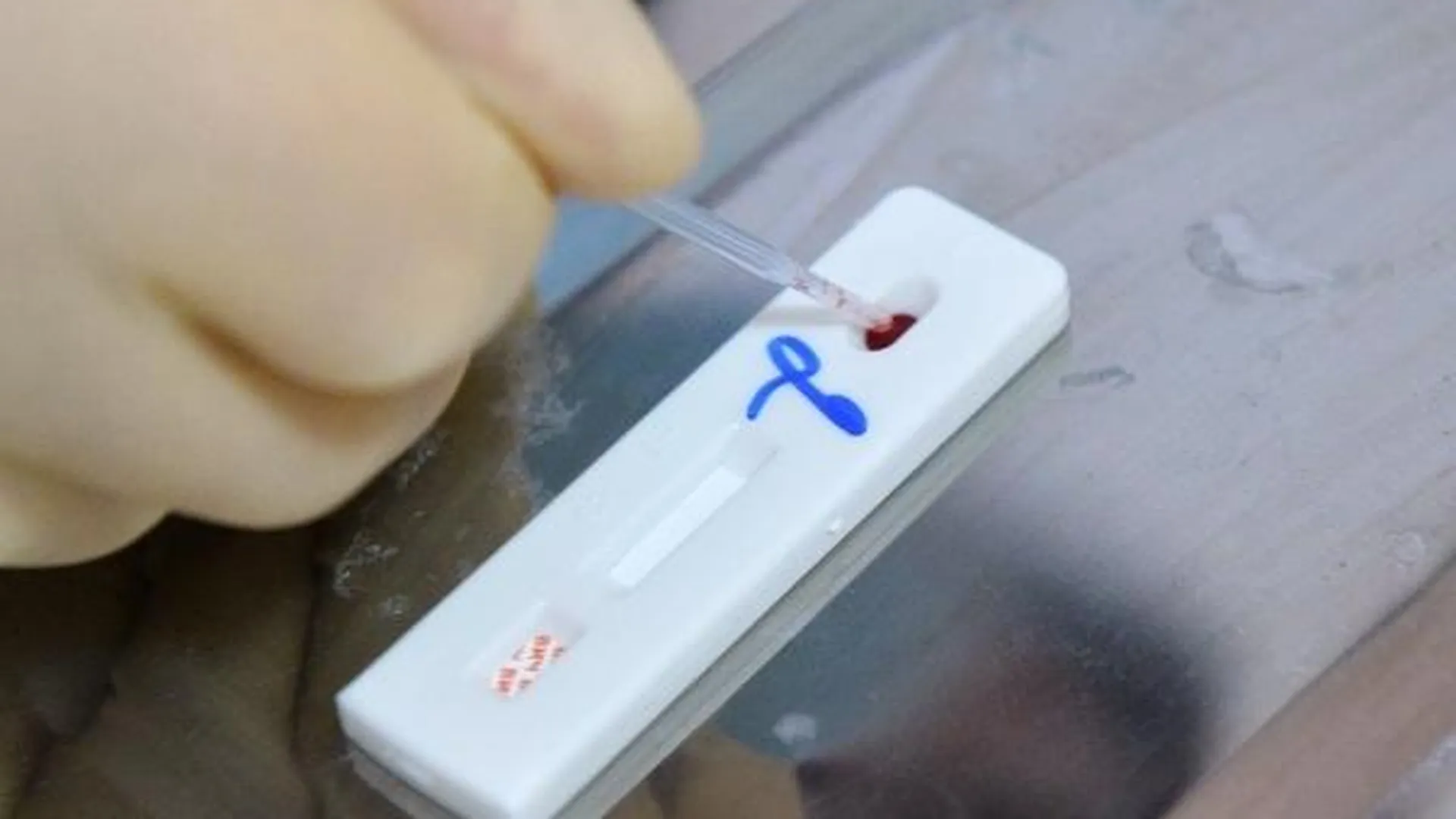 Бригады центра СПИД проведут тестирование на ВИЧ в Пушкино и Ликино-Дулево