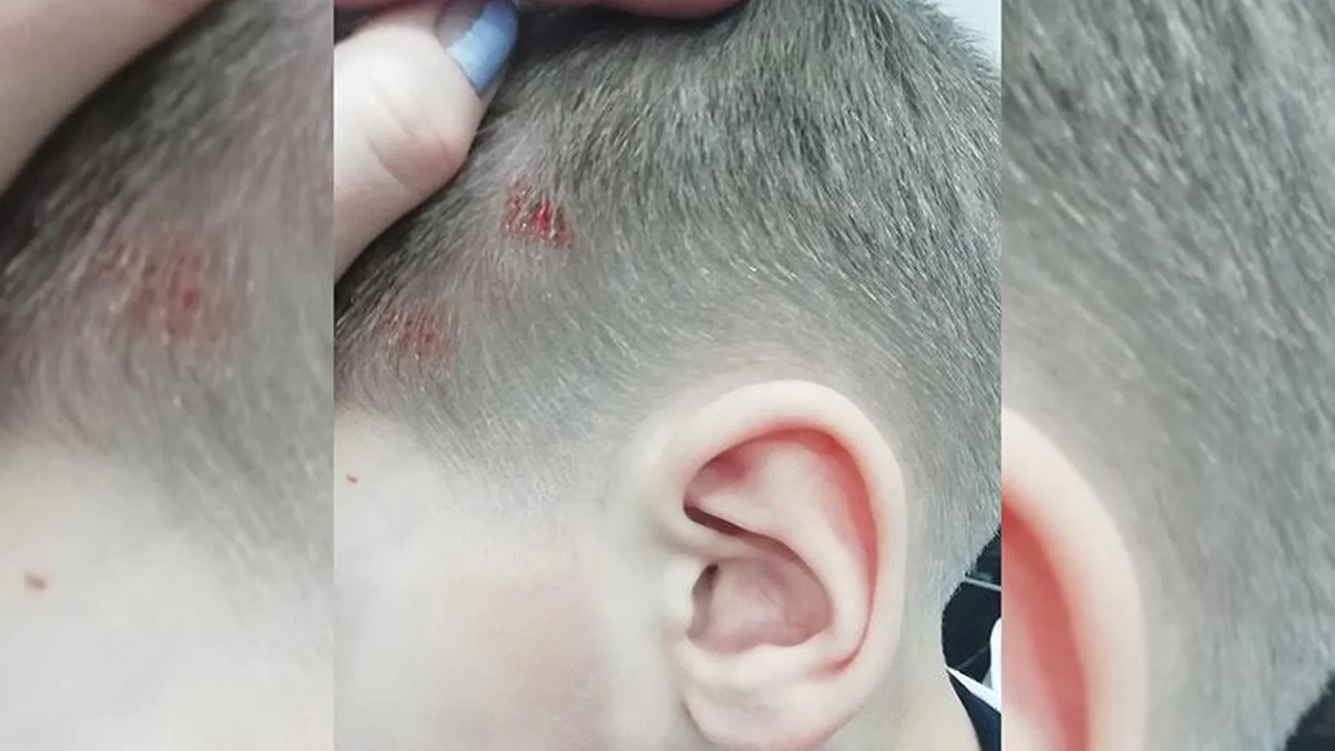 УК из Подольска узнала о разбившем голову мальчике из соцсетей