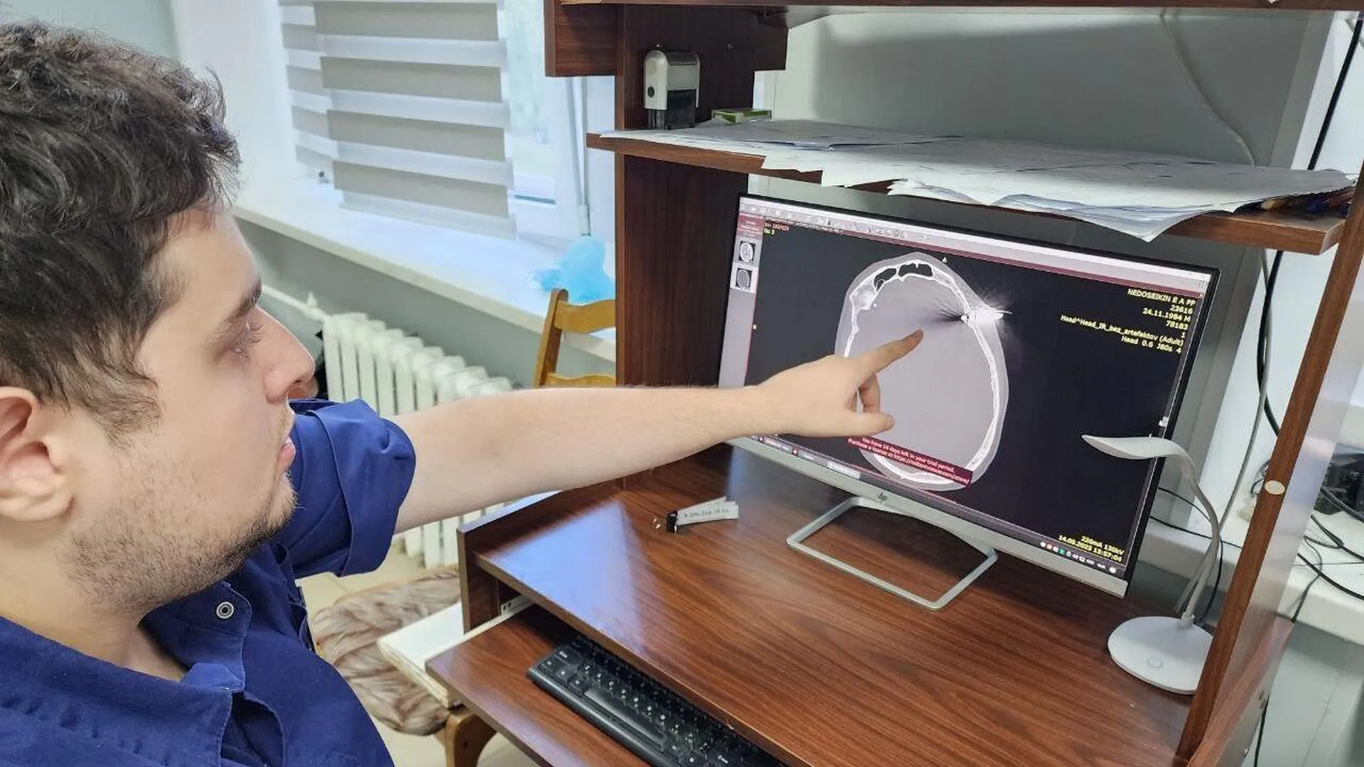 В подмосковном Солнечногорске врачи извлекли арбалетную стрелу из головного мозга пациента