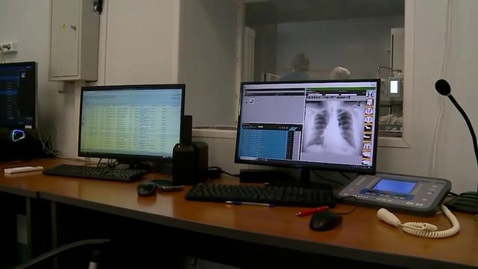 Два новых рентген-аппарата установили в больнице в Мытищах