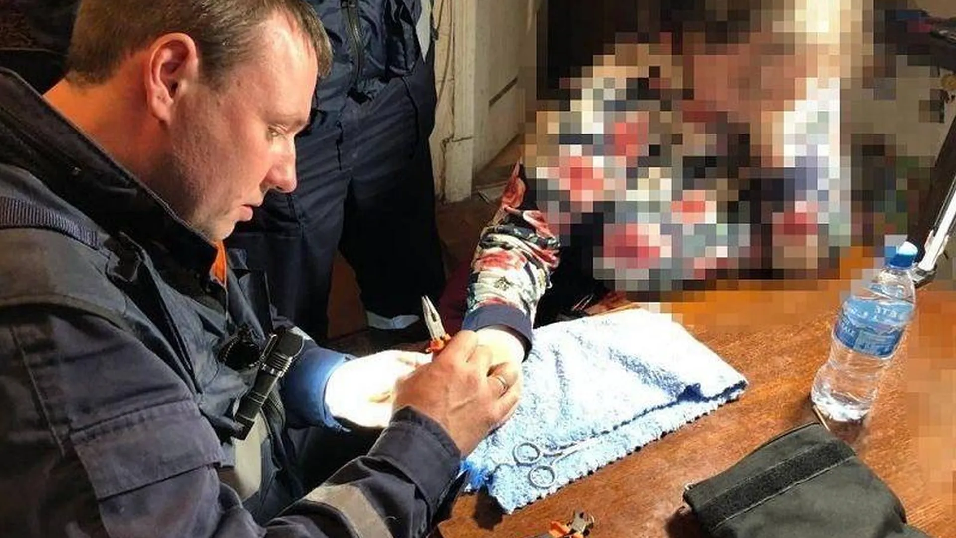 Подмосковные спасатели помогли жительнице Краснозаводска избавиться от застрявших на пальце колец