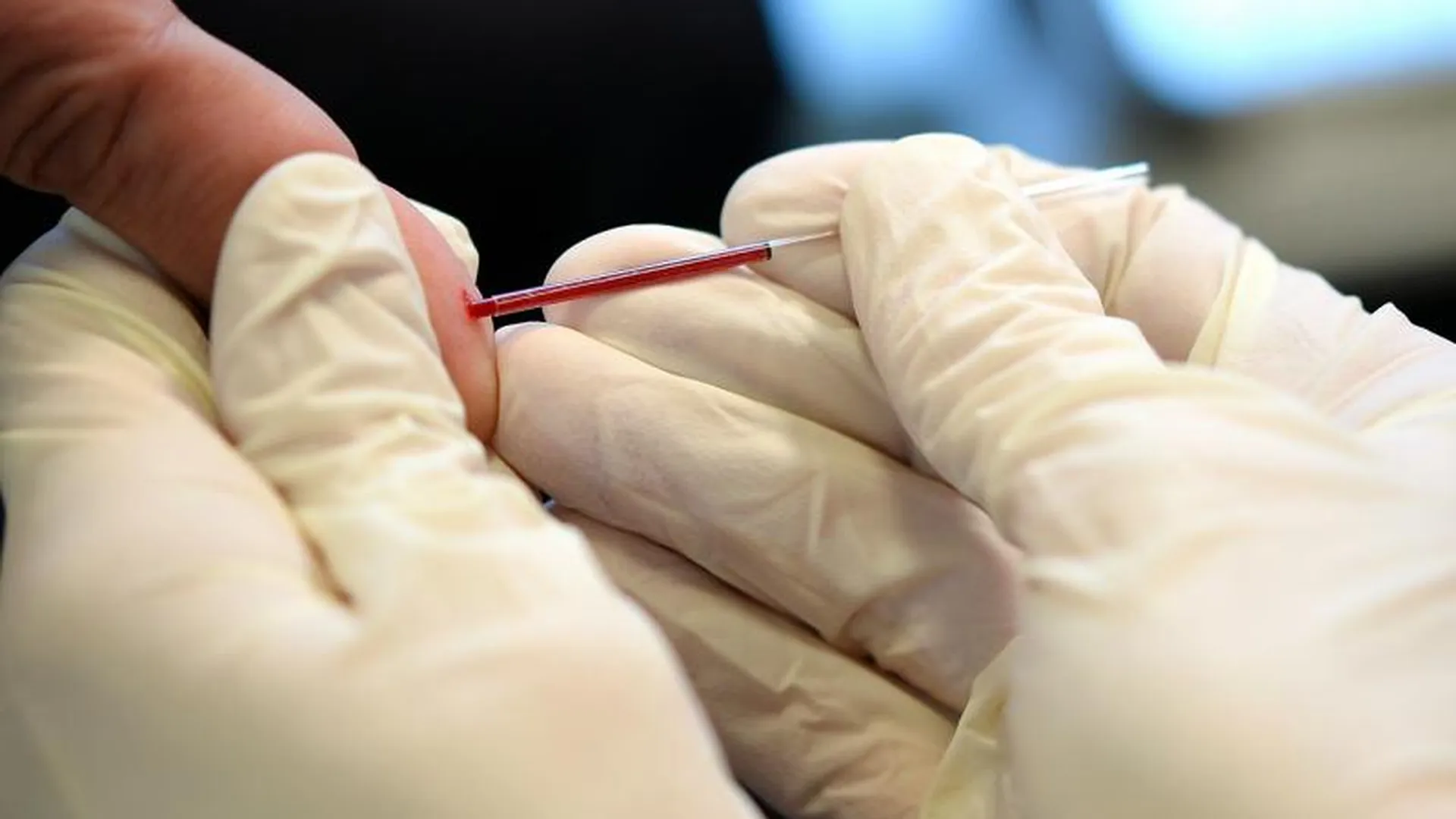 Ученые смогут выявлять бесплодие по анализу крови