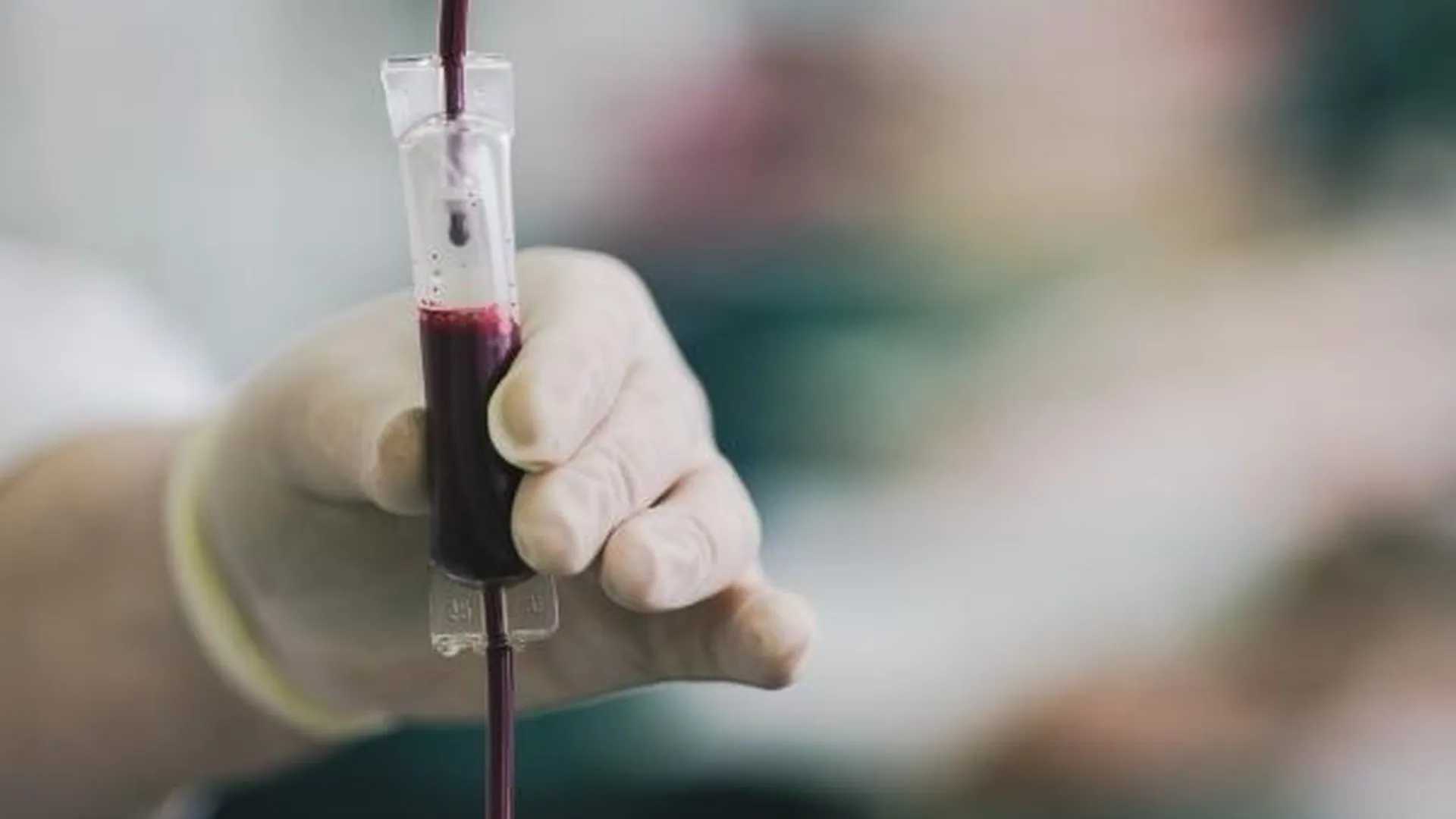 Мужчине, которому электричка отрезала ноги под Солнечногорском, нужна донорская кровь