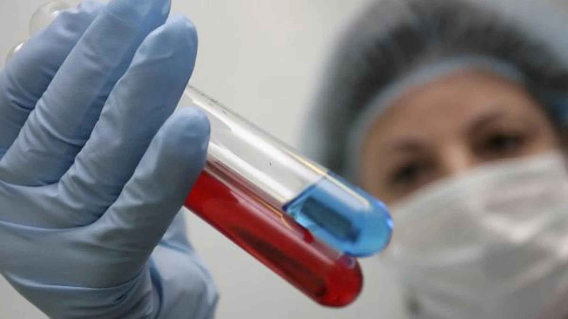 Ученые Подмосковья разработали вакцину от лихорадки Эбола