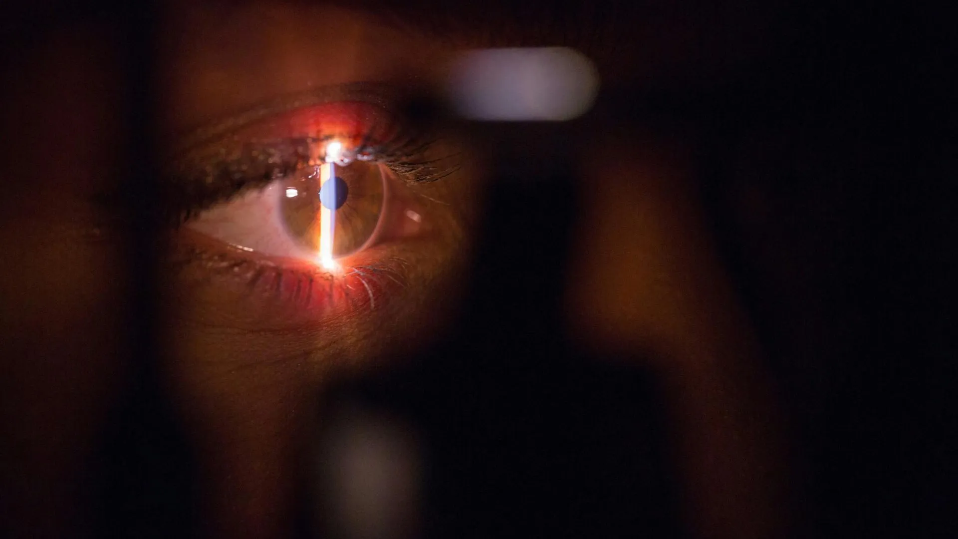 Ослепшая на один глаз россиянка добилась суда над покалечившим ее врачом