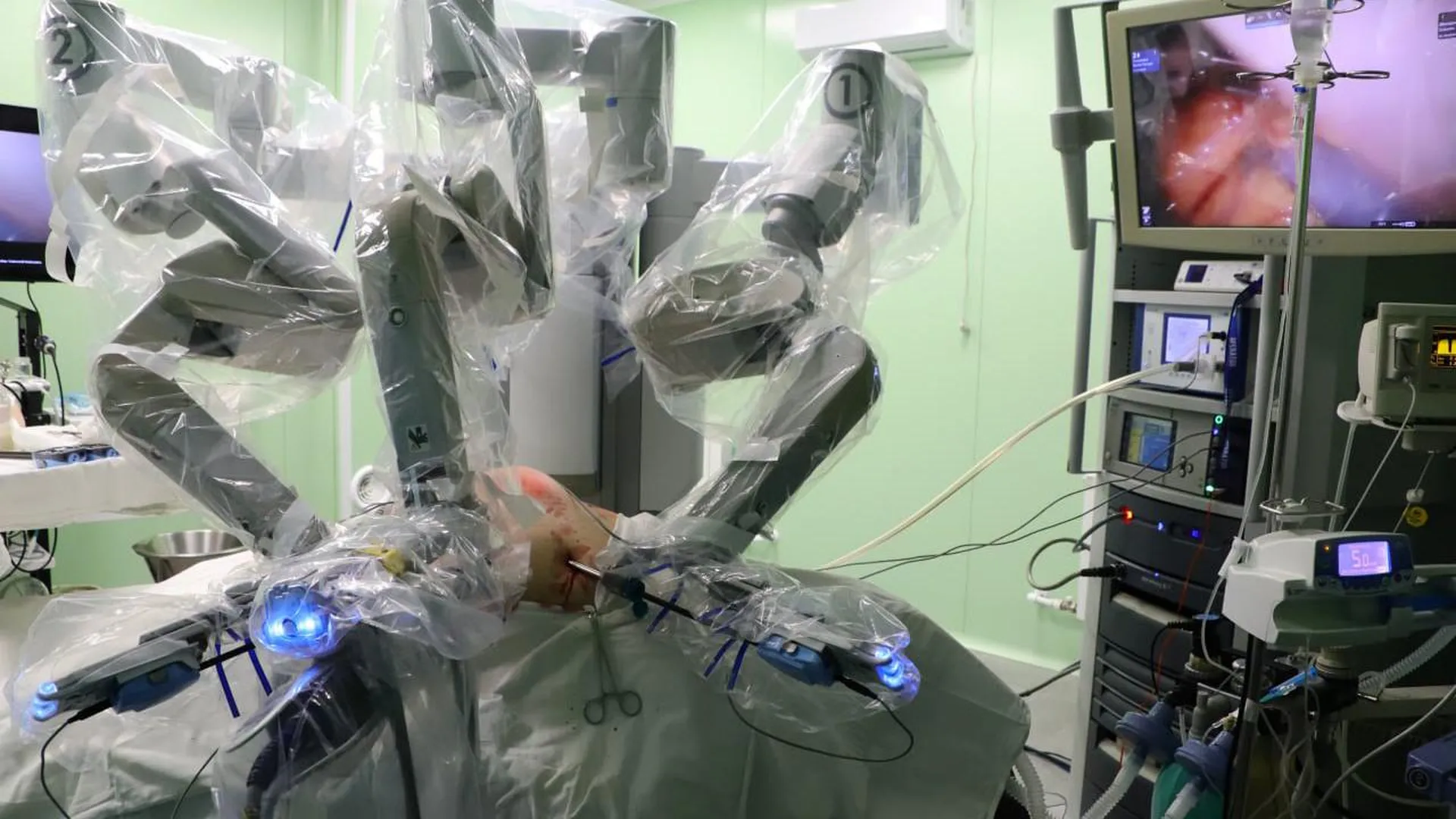 В Воскресенской больнице начали проводить операции с помощью робота