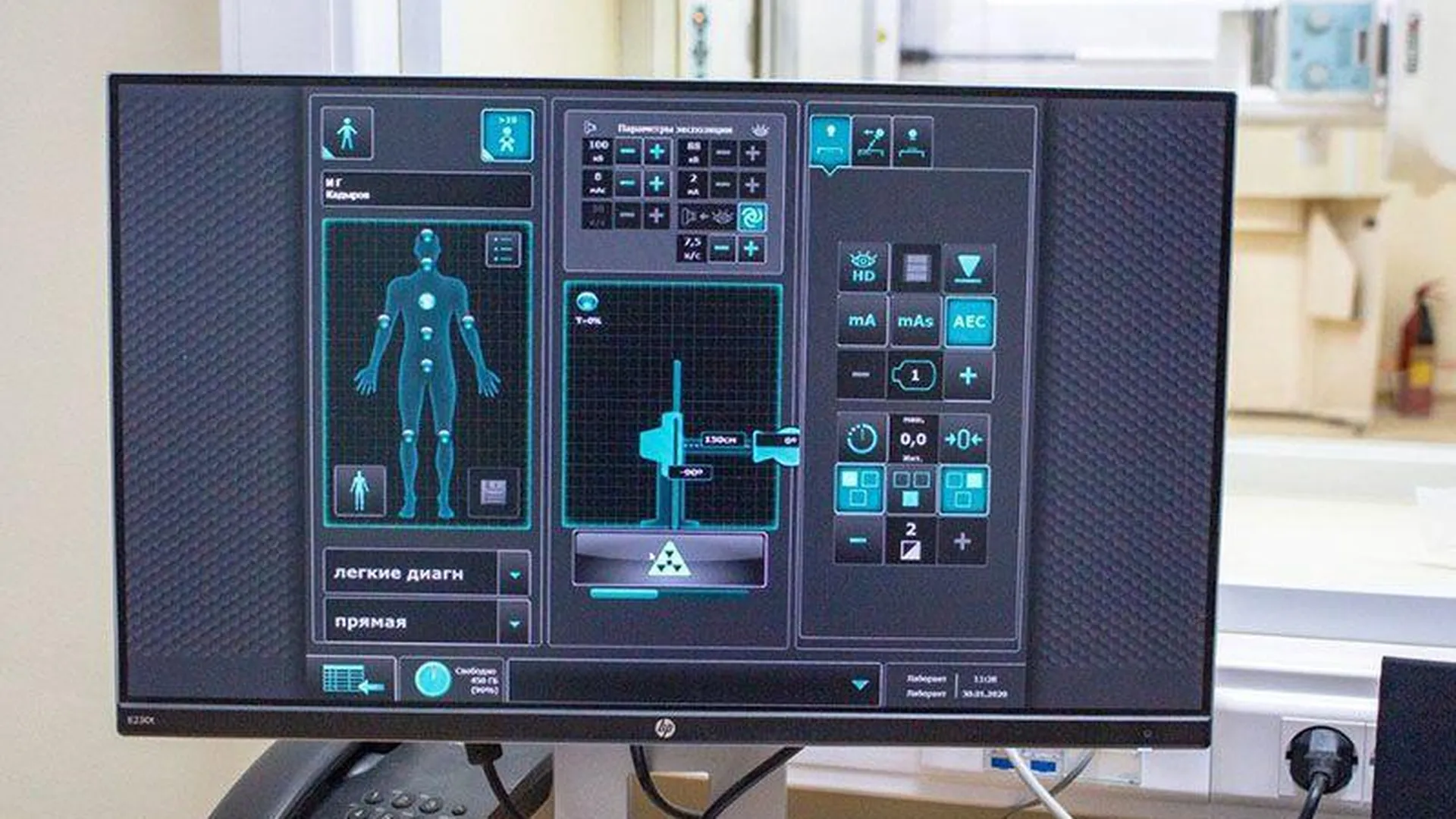 Новый рентген-аппарат поступил в Павлово-Посадскую ЦРБ