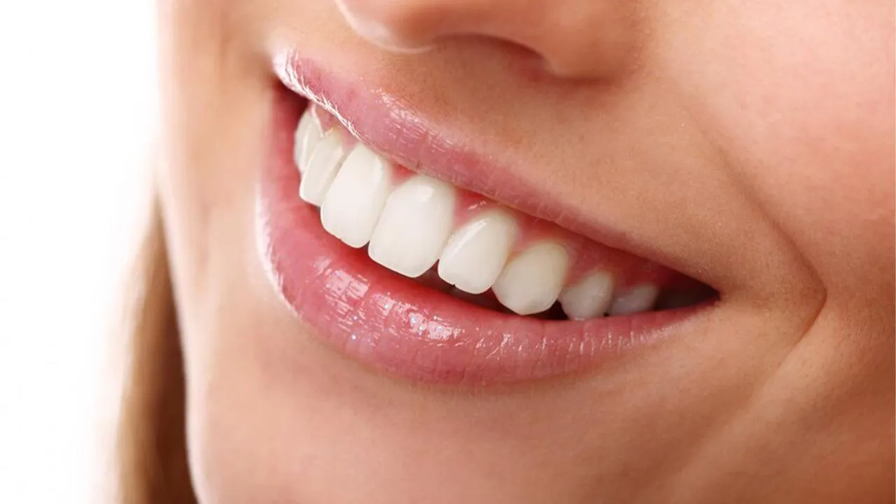 «Развитие кариозного процесса»: раскрыта опасность домашнего отбеливания зубов