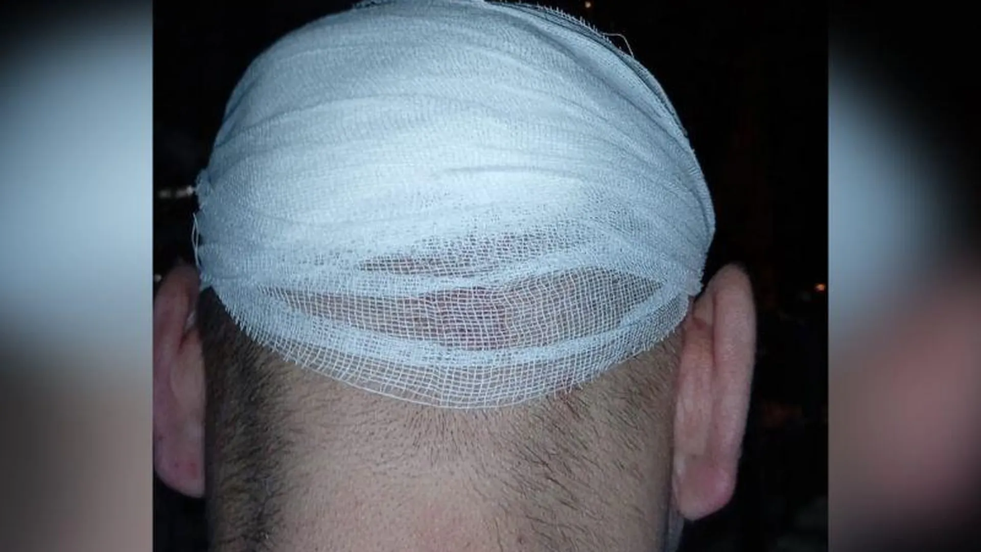Мужчина разбил голову на крутой лестнице магазина в Видном