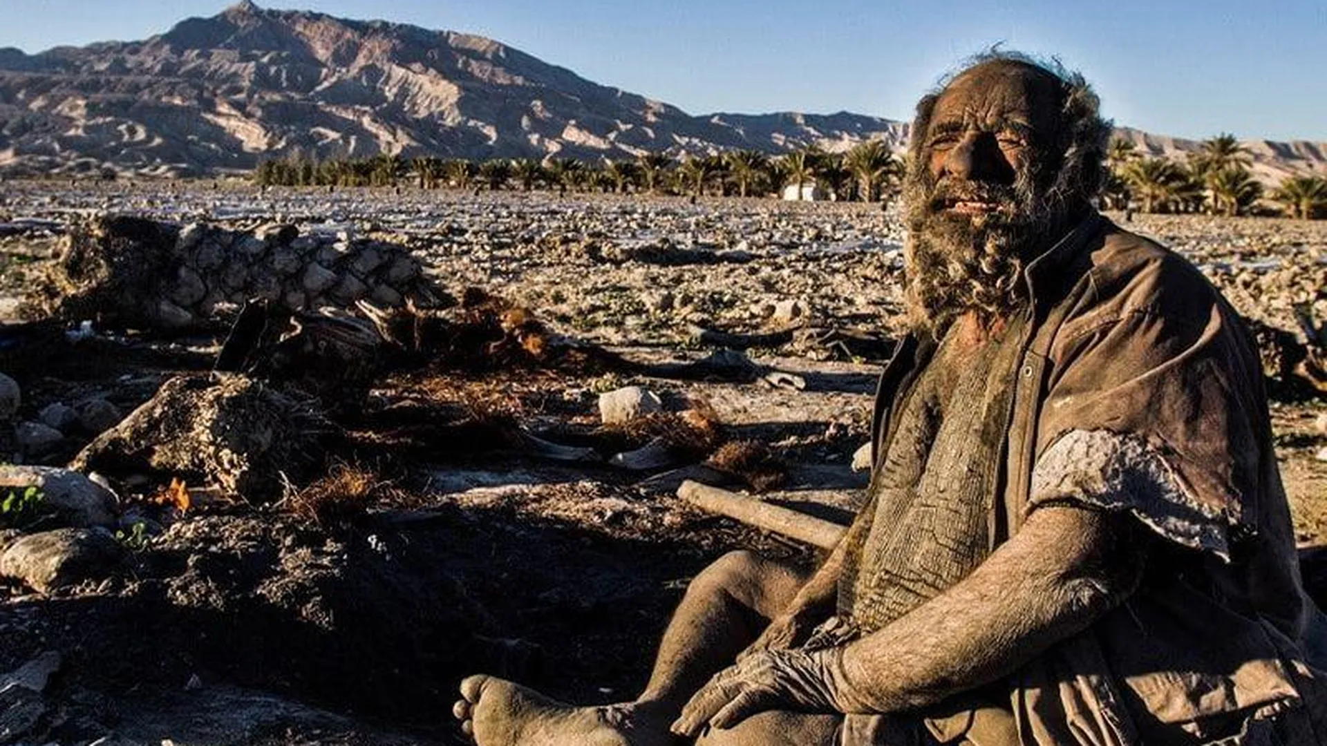 Самый грязный человек в мире скончался после того, как впервые за десятки лет помылся
