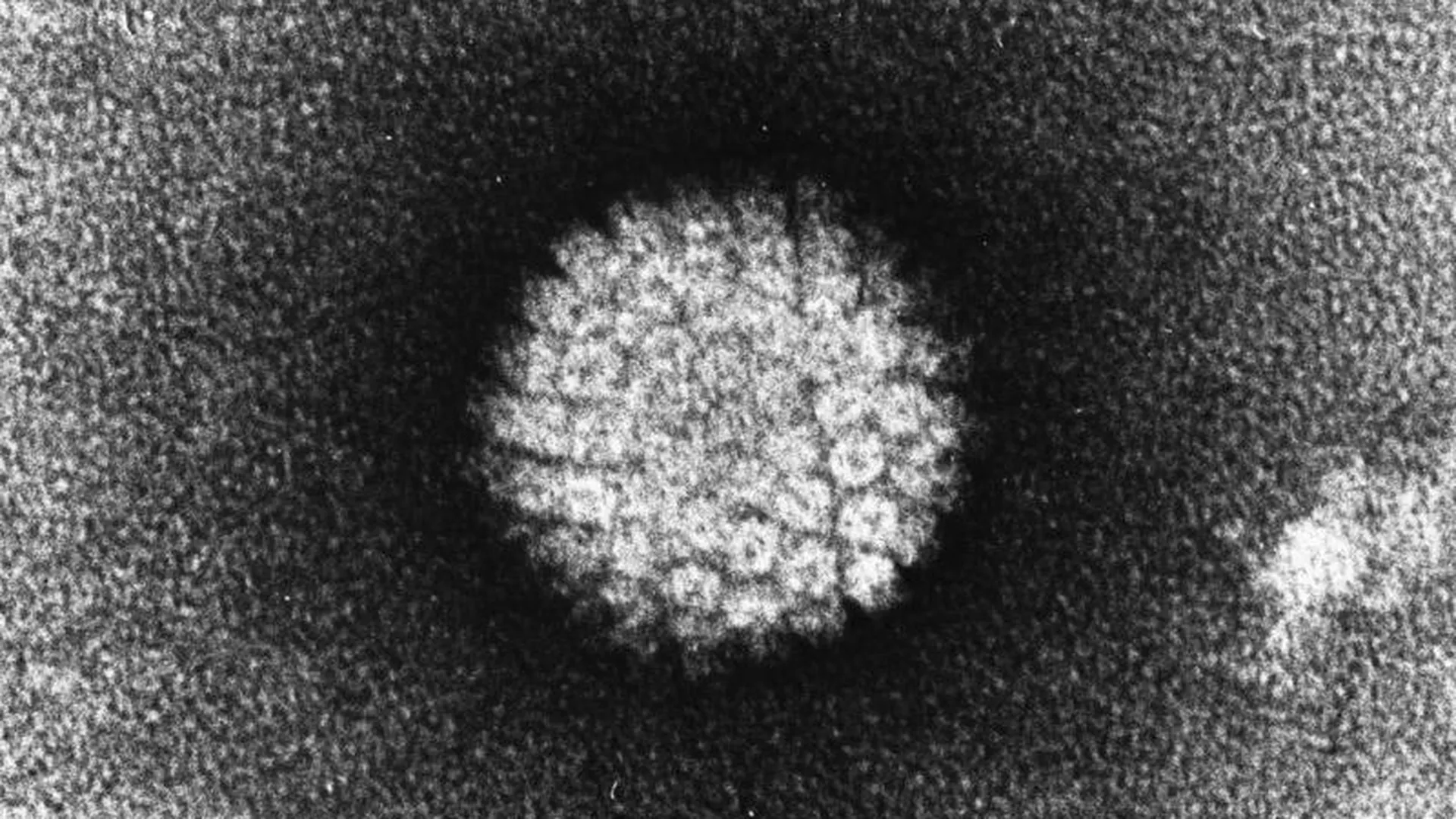Почти половина мужчин в США инфицированы вирусом папилломы