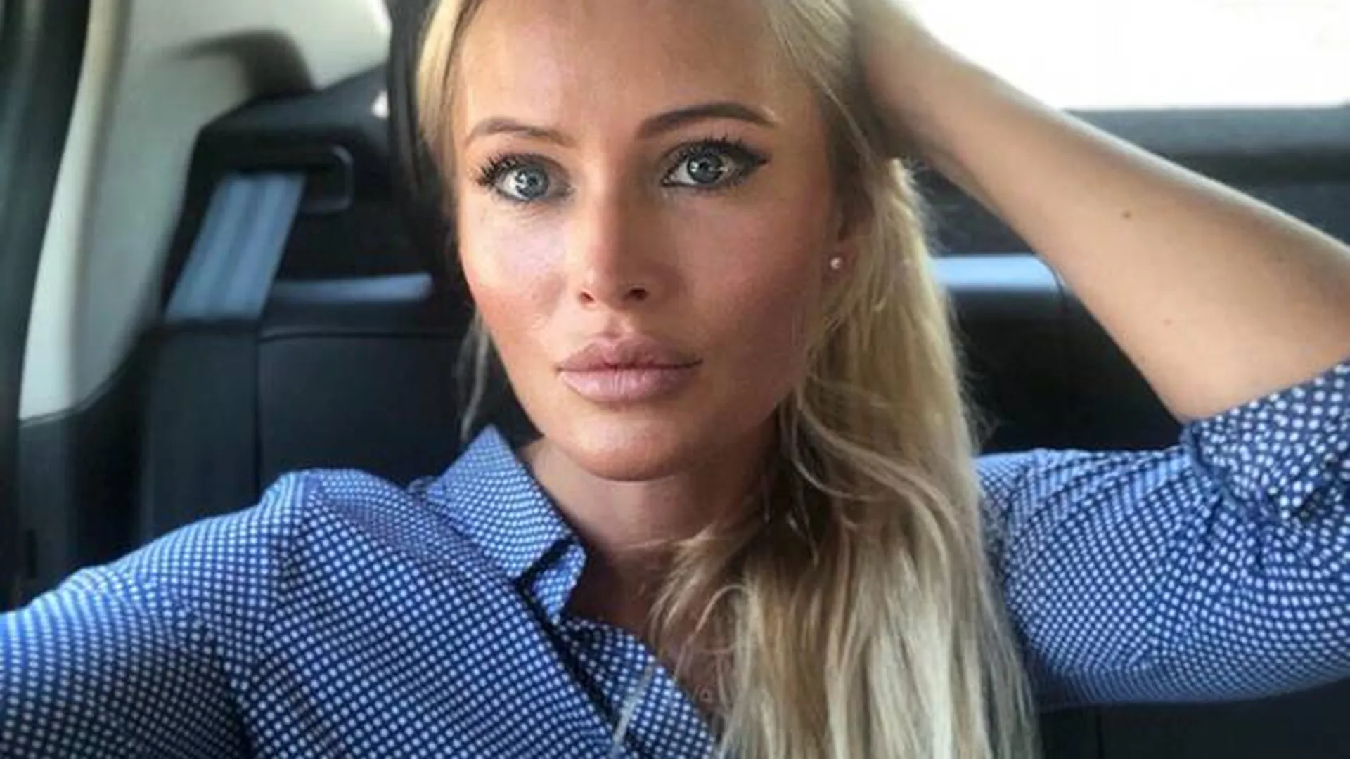 Дана Борисова в четвертый раз сделала пластическую операцию