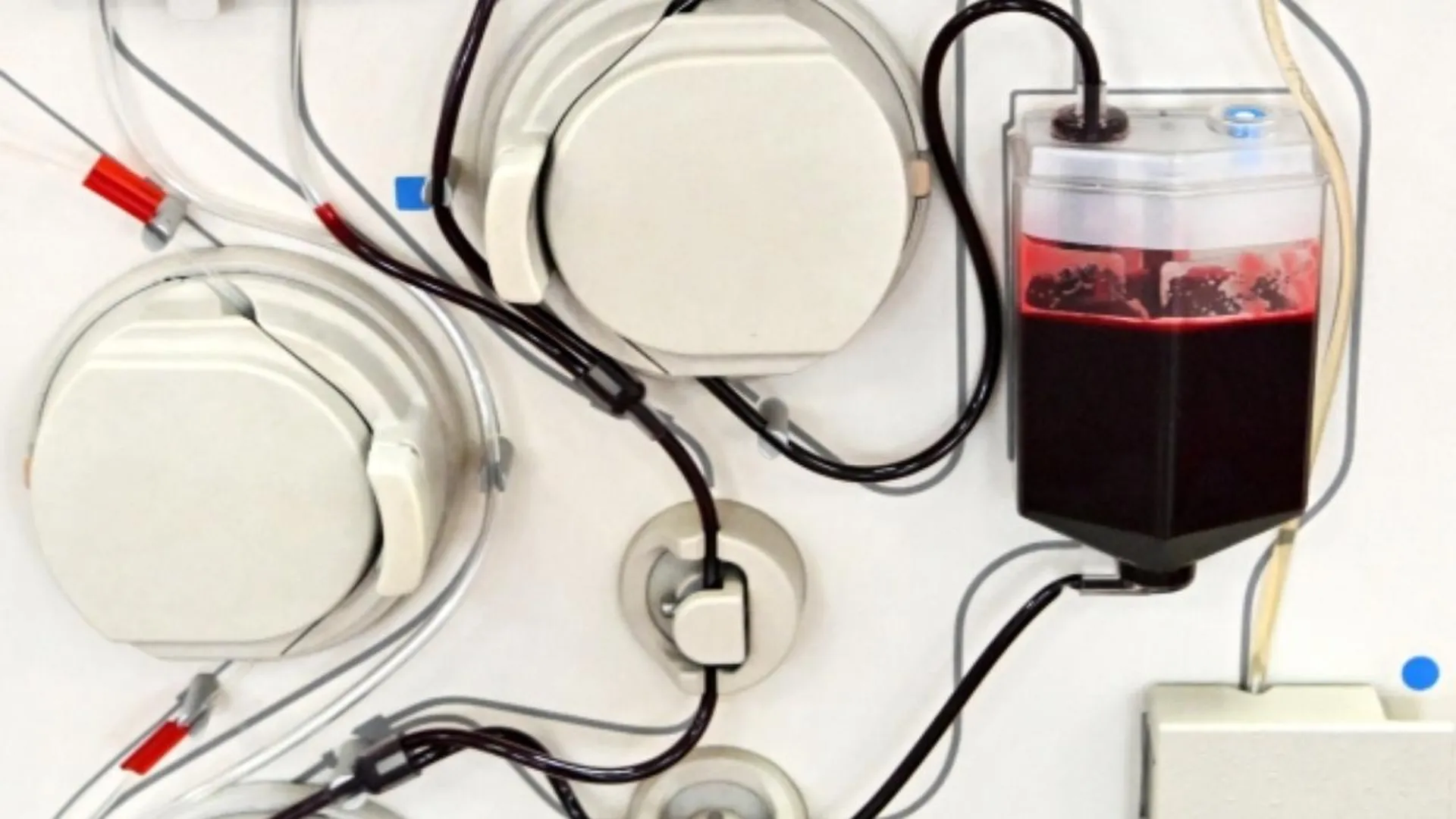 Врачи в Солнечногорске спасли пациента, потерявшего два литра крови