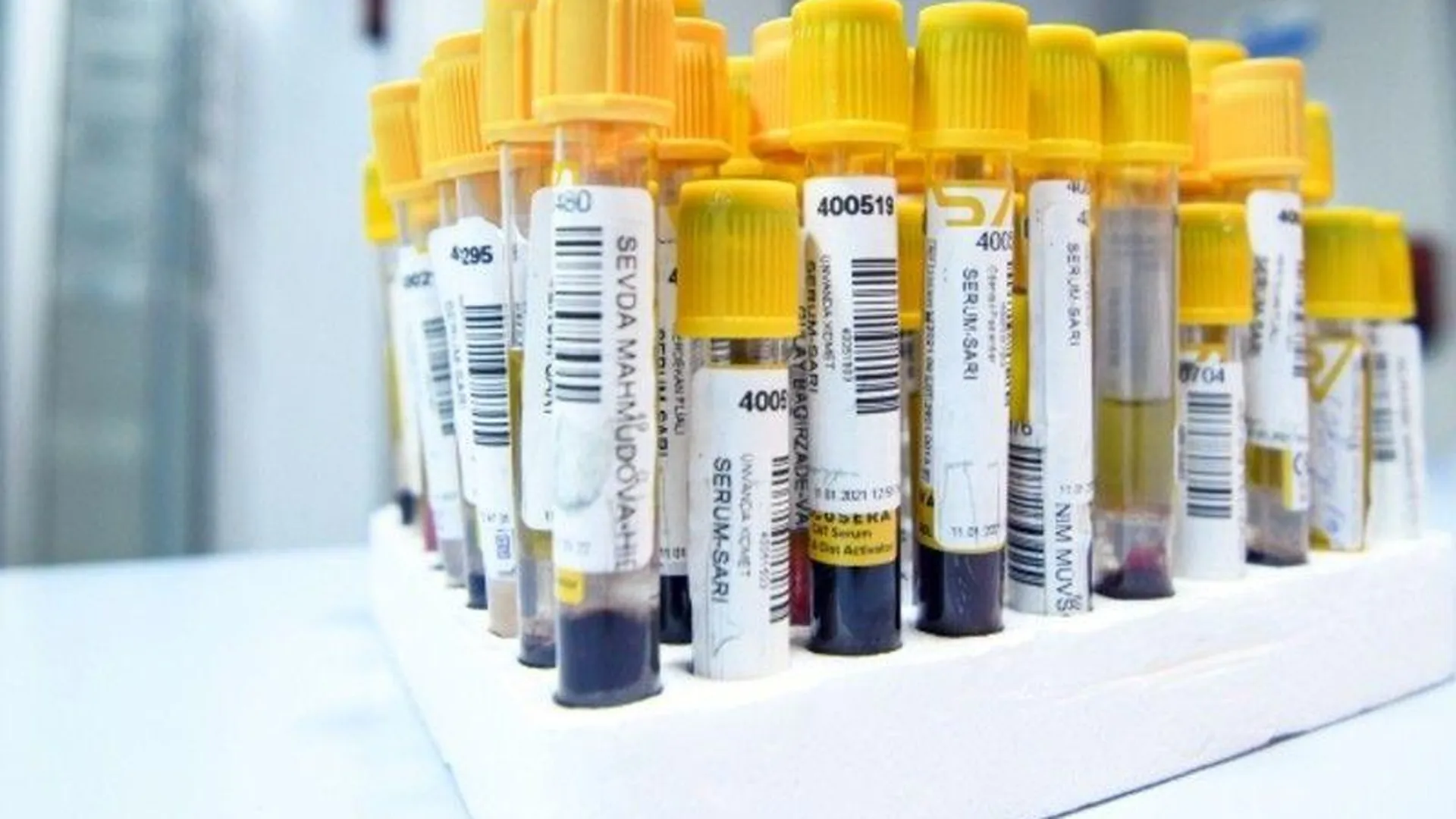 За сутки в Подмосковье выявили 1240 случаев заболевания коронавирусом
