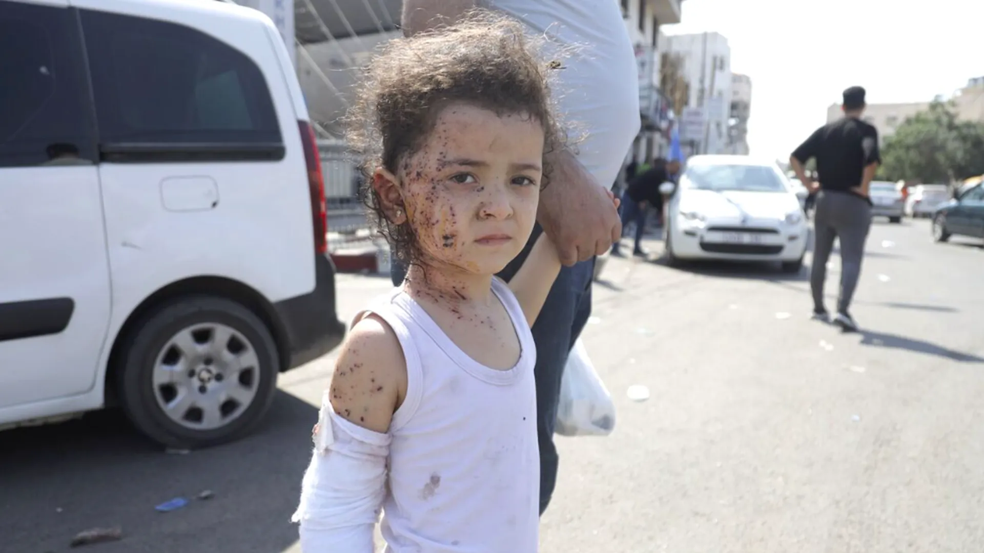 Ребенок, пострадавший в результате ракетных ударов ВС Израиля по Газе